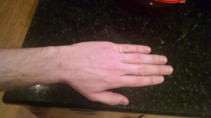 ManuForm: custom contoured 50% ergo board 117254-1