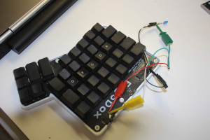 Help!! Ergodox Thumb Keys Aren't Working! 116417-1